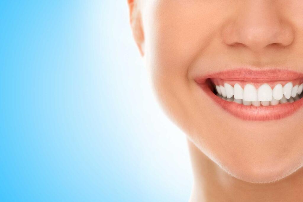 Smile makeover in Marmaris Turkey